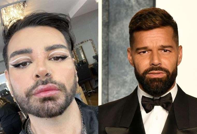 Se somete a más de 30 cirugías para parecerse a Ricky Martin